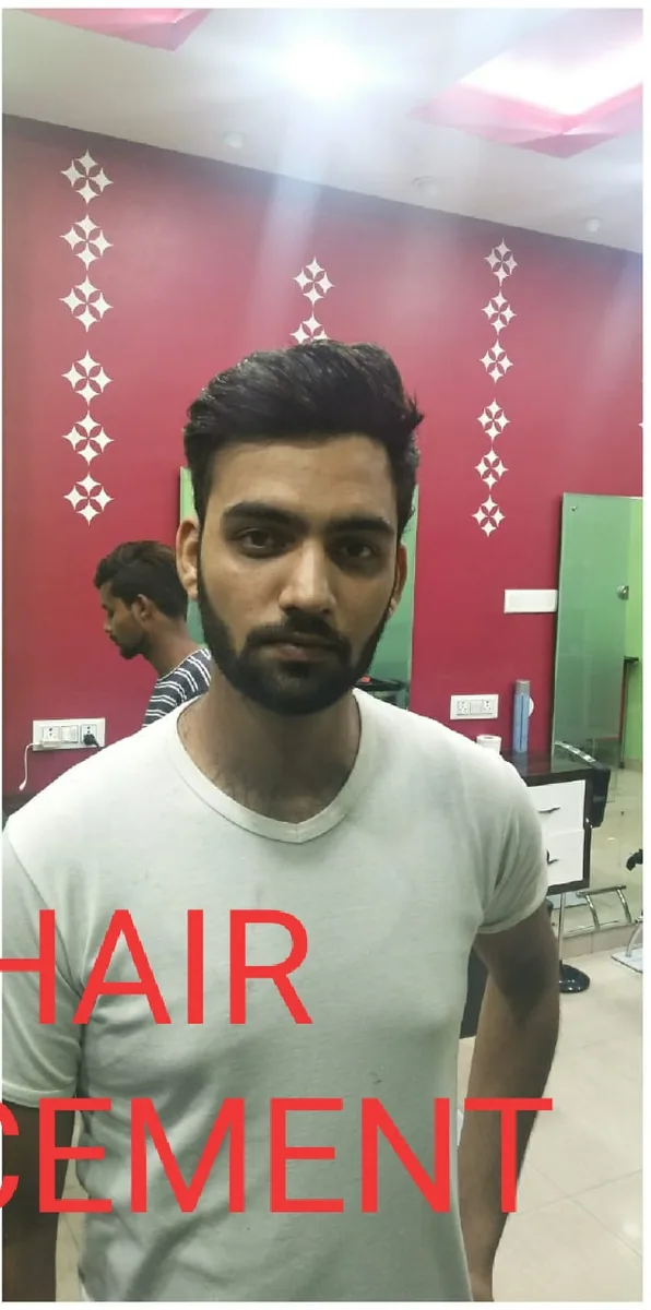 After: full coverage with a custom hair unit