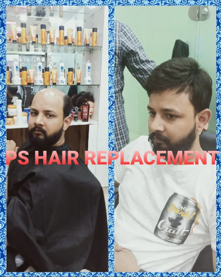 Before and after: crown and top restored