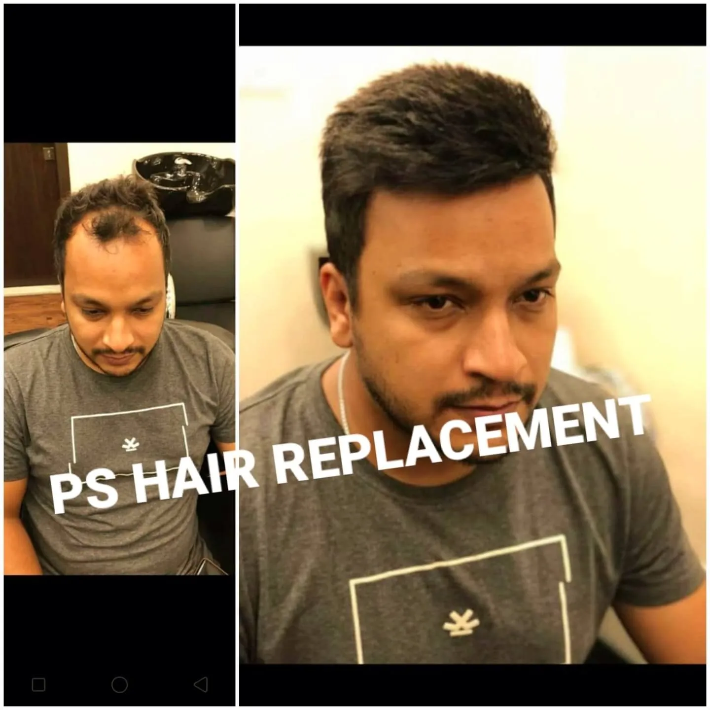 Hair Patch